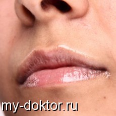 5     - MY-DOKTOR.RU