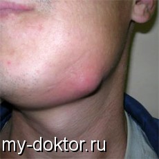   - MY-DOKTOR.RU