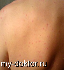      - MY-DOKTOR.RU