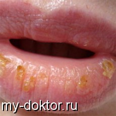   - MY-DOKTOR.RU