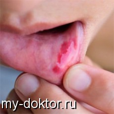   - MY-DOKTOR.RU