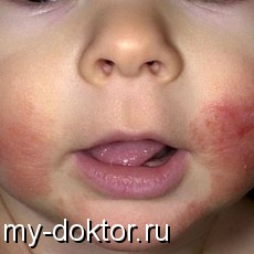      ! - MY-DOKTOR.RU