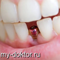          - MY-DOKTOR.RU