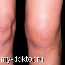   - MY-DOKTOR.RU