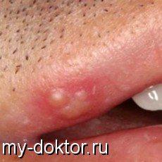        ? - MY-DOKTOR.RU