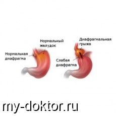  : ,    - MY-DOKTOR.RU