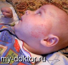    - MY-DOKTOR.RU