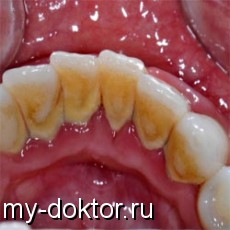       - MY-DOKTOR.RU