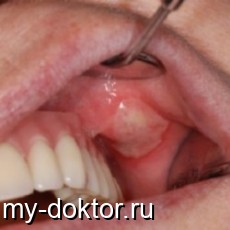  . . . .  - MY-DOKTOR.RU