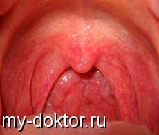   ,    - MY-DOKTOR.RU