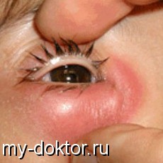    - MY-DOKTOR.RU