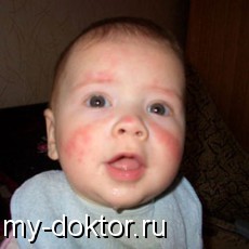     - MY-DOKTOR.RU