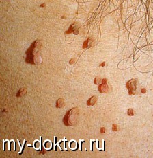   !        - MY-DOKTOR.RU