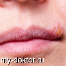 . . . .  - MY-DOKTOR.RU