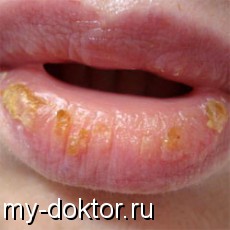     ? - MY-DOKTOR.RU