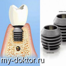  Bicon    - MY-DOKTOR.RU