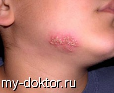   ? - MY-DOKTOR.RU