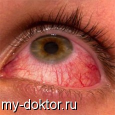      - MY-DOKTOR.RU