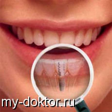      - MY-DOKTOR.RU