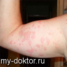    ,    (-) - MY-DOKTOR.RU