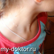  . ,    - MY-DOKTOR.RU