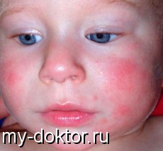   - MY-DOKTOR.RU