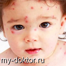 , , ,  - MY-DOKTOR.RU