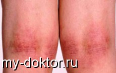     - MY-DOKTOR.RU