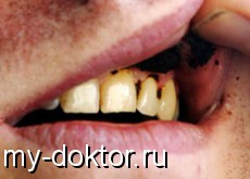       - MY-DOKTOR.RU