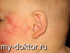    - MY-DOKTOR.RU