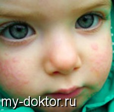     - MY-DOKTOR.RU