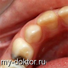         - - MY-DOKTOR.RU