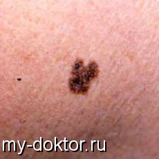  :  ,  . , ,   - MY-DOKTOR.RU