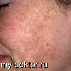 : , , ,  - MY-DOKTOR.RU