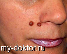       - MY-DOKTOR.RU