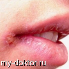     -  (-) - MY-DOKTOR.RU