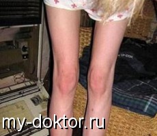     - MY-DOKTOR.RU