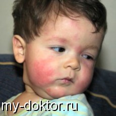    ! - MY-DOKTOR.RU