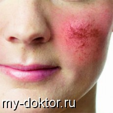       - MY-DOKTOR.RU