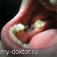      ? - MY-DOKTOR.RU