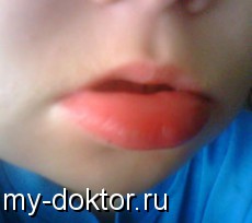   - MY-DOKTOR.RU