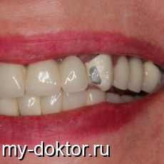    :   ? - MY-DOKTOR.RU