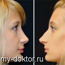     - MY-DOKTOR.RU