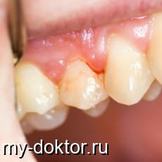 : , , ,   - MY-DOKTOR.RU