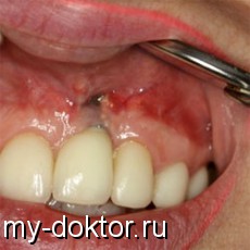 :  , ,  ,  - MY-DOKTOR.RU