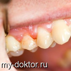 .     - MY-DOKTOR.RU