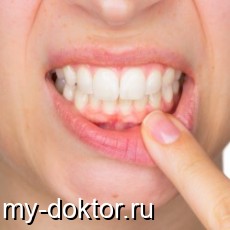    - MY-DOKTOR.RU