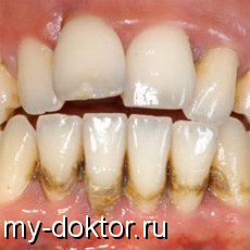  -  :  - MY-DOKTOR.RU