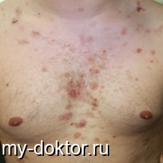 . . . .  - MY-DOKTOR.RU