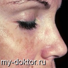    - MY-DOKTOR.RU